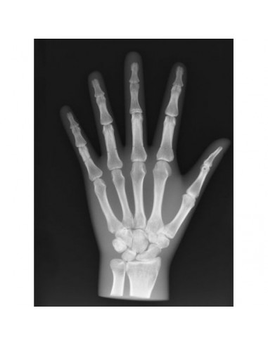 Simulador de radiología - Mano opaca...