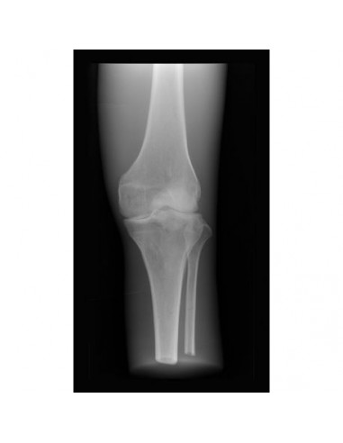 Simulador para radiología - Rodilla...