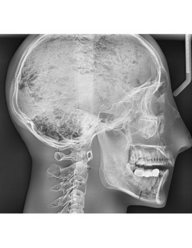 Simulador para radiología - Cráneo...